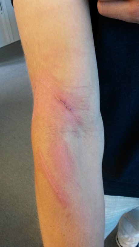 Dies ist der Arm, am restlichen Körper ginge es weiter ...